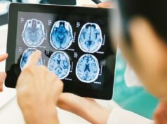 Ahli Saraf Ungkap 3 Kebiasaan yang Rusak Otak, Sering Dilakukan saat Bangun Tidur