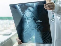 Biar Enggak Jadi ‘Remaja Jompo’, Ini 7 Cara Menjaga Kesehatan Tulang