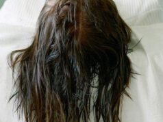 7 Bahaya Tidur dengan Rambut Basah, Bikin Jerawat di Kulit Kepala