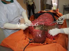 Depresi dan Tinggal Sendiri, Warga Blitar Ditemukan Meninggal di Rumahnya