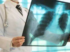 Edukasi TBC Diperkuat, Warga Diimbau Tak Abaikan Gejala Awal